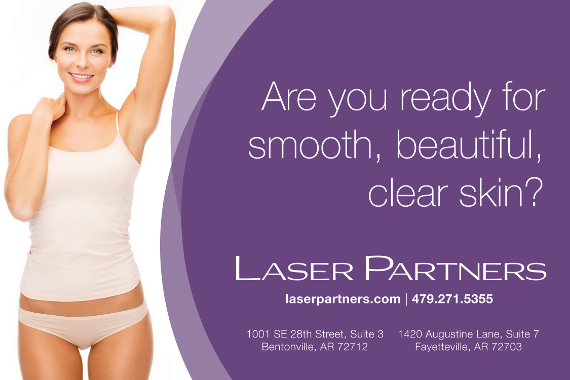 FY14_Laser_Partners_Memberships_Promotion_950x700