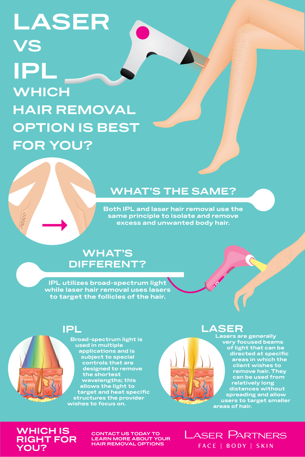 Laser vs IPL hair removal: which is best?